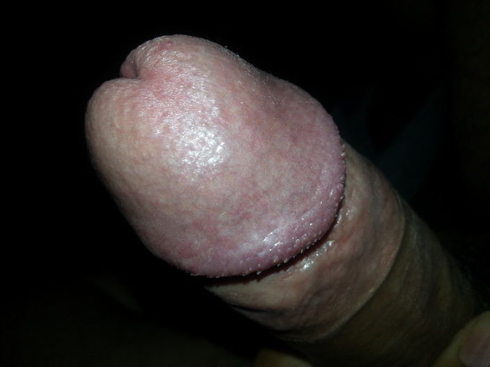 Mr. Dick