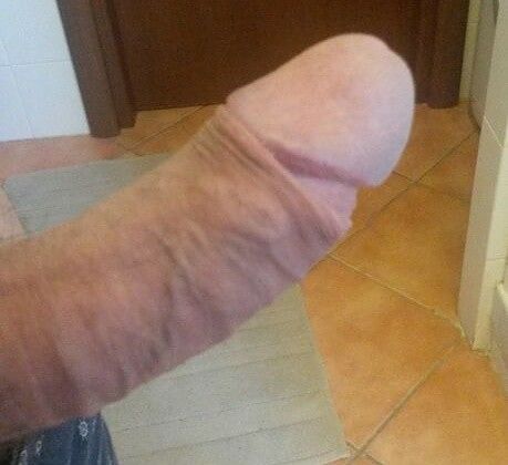 my penis