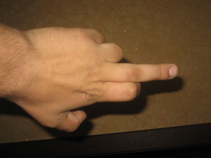 всем уродам