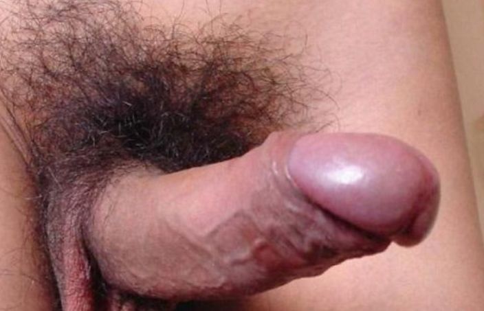 ###