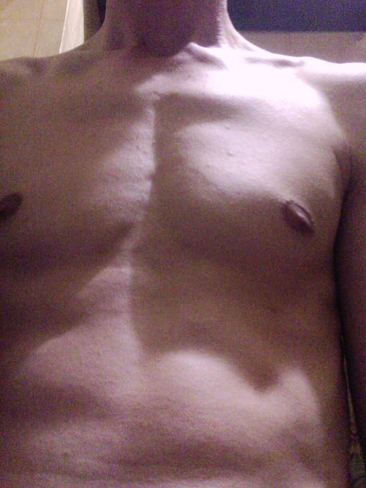 тело хочет секса