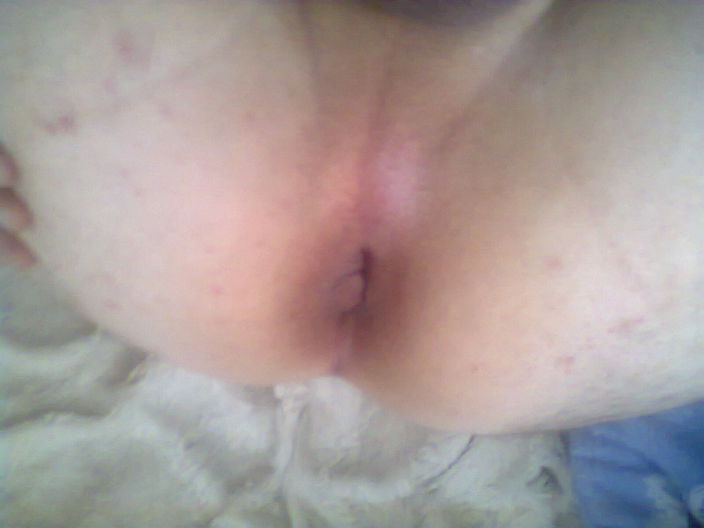 xxx