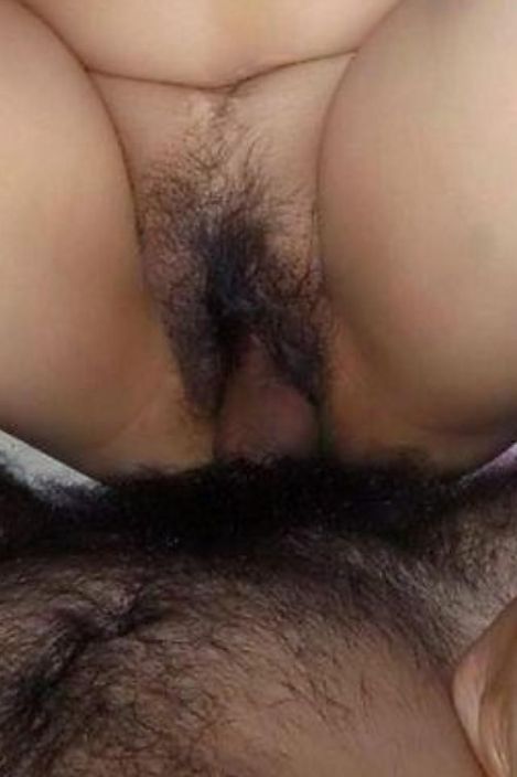 hairy