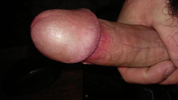 .........................