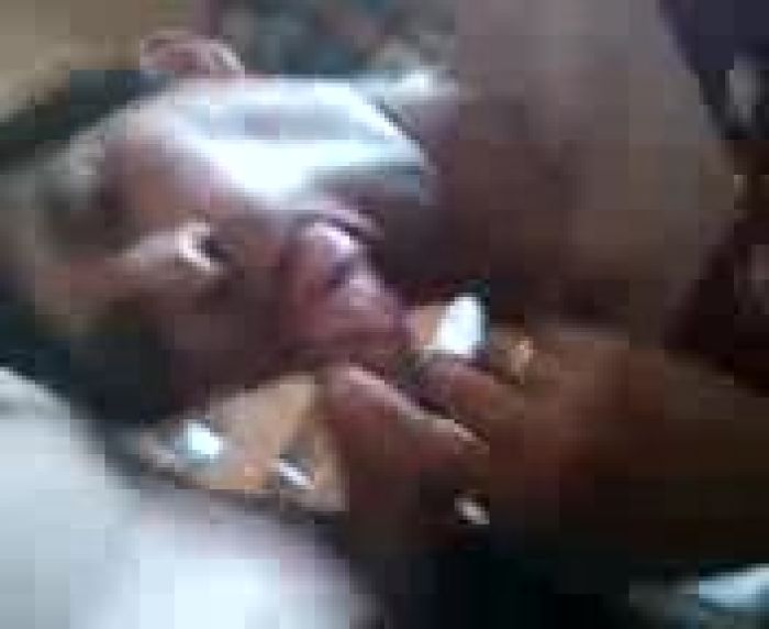 у кости сосу